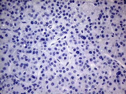 PMP22 Antibody (OTI5D1) Immunohistochemistry;PMP22 Antibody (OTI5D1)[NBP3-44709]-