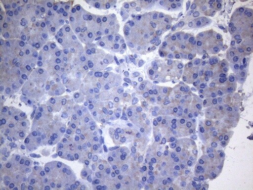 Cytohesin 2 Antibody (OTI4D9) Immunohistochemistry;Cytohesin 2 Antibody (OTI4D9)[NBP3-44710]-