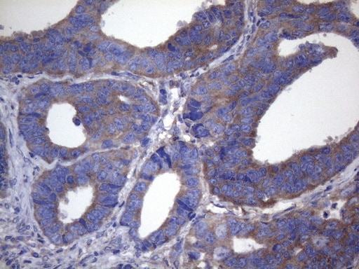 Cytohesin 2 Antibody (OTI4D9) Immunohistochemistry;Cytohesin 2 Antibody (OTI4D9)[NBP3-44710]-