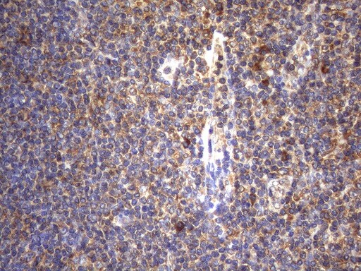 Cytohesin 2 Antibody (OTI4D9) Immunohistochemistry;Cytohesin 2 Antibody (OTI4D9)[NBP3-44710]-