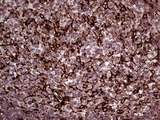 ERLIN1 Antibody (OTI4B1) Immunohistochemistry;ERLIN1 Antibody (OTI4B1)[NBP3-44713]-