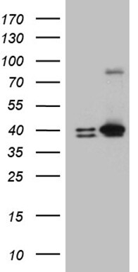 ERLIN1 Antibody (OTI4B1) Western Blot;ERLIN1 Antibody (OTI4B1)[NBP3-44713]-