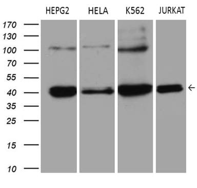 ERLIN1 Antibody (OTI4B1) Western Blot;ERLIN1 Antibody (OTI4B1)[NBP3-44713]-