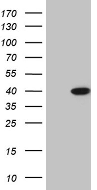 ERLIN1 Antibody (OTI4C11) Western Blot;ERLIN1 Antibody (OTI4C11)[NBP3-44714]-