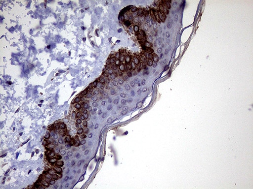 P4HA3 Antibody (OTI9A2) Immunohistochemistry;P4HA3 Antibody (OTI9A2)[NBP3-44719]-