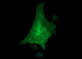Tyrosine Hydroxylase Antibody (OTI1A12)