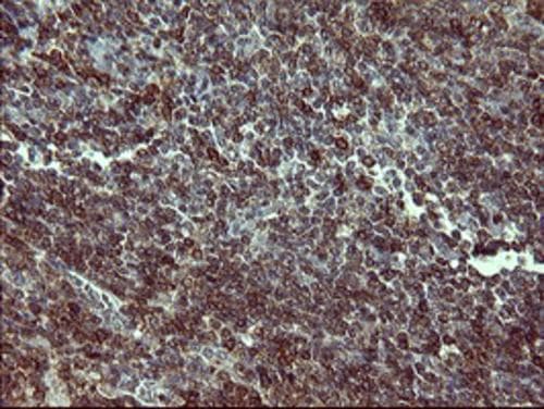 Tyrosine Hydroxylase Antibody (OTI1A12)