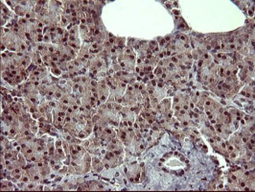 Tyrosine Hydroxylase Antibody (OTI1A12) Immunohistochemistry;Tyrosine Hydroxylase Antibody (OTI1A12)[NBP3-44720]-