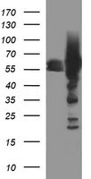 Tyrosine Hydroxylase Antibody (OTI1A12) Western Blot;Tyrosine Hydroxylase Antibody (OTI1A12)[NBP3-44720]-