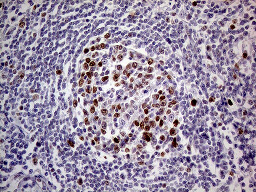 MAGEB4 Antibody (OTI1B5) Immunohistochemistry;MAGEB4 Antibody (OTI1B5)[NBP3-44723]-