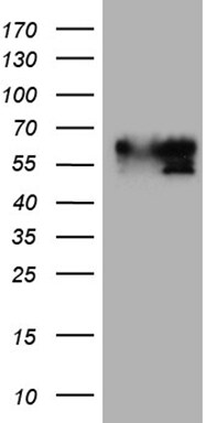 BNIPL Antibody (OTI2E8) Western Blot;BNIPL Antibody (OTI2E8)[NBP3-44724]-