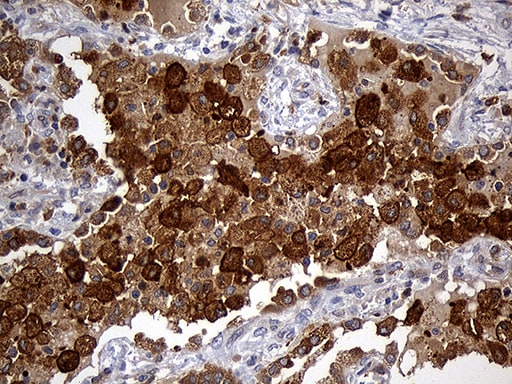 GRB7 Antibody (OTI6H2) Immunohistochemistry;GRB7 Antibody (OTI6H2)[NBP3-44728]-
