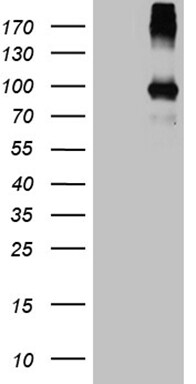 PAMR1 Antibody (OTI4E2) Western Blot;PAMR1 Antibody (OTI4E2)[NBP3-44730]-