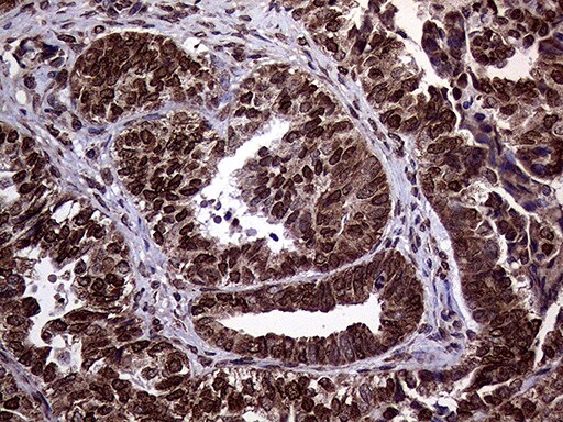 TRMT5 Antibody (OTI1B5) Immunohistochemistry;TRMT5 Antibody (OTI1B5)[NBP3-44733]-