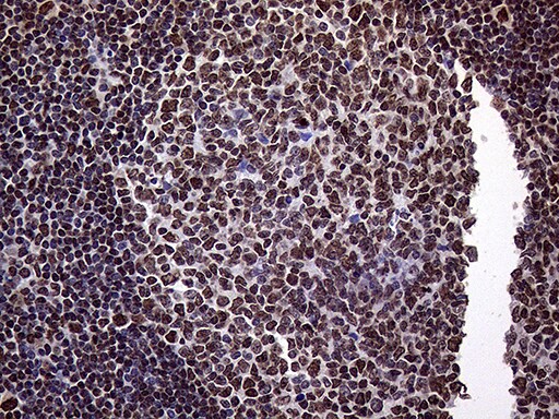 TRMT5 Antibody (OTI1B5) Immunohistochemistry;TRMT5 Antibody (OTI1B5)[NBP3-44733]-