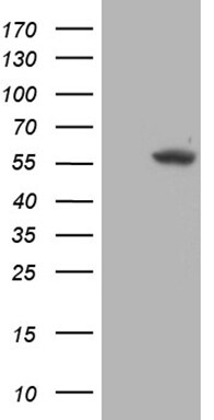 TRMT5 Antibody (OTI1B5) Western Blot;TRMT5 Antibody (OTI1B5)[NBP3-44733]-