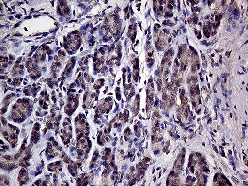 HABP2 Antibody (OTI5H3) Immunohistochemistry;HABP2 Antibody (OTI5H3)[NBP3-44737]-