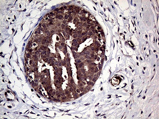 HABP2 Antibody (OTI5H3) Immunohistochemistry;HABP2 Antibody (OTI5H3)[NBP3-44737]-