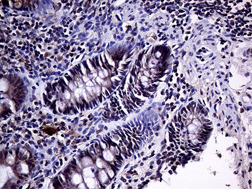 HABP2 Antibody (OTI5H3) Immunohistochemistry;HABP2 Antibody (OTI5H3)[NBP3-44737]-