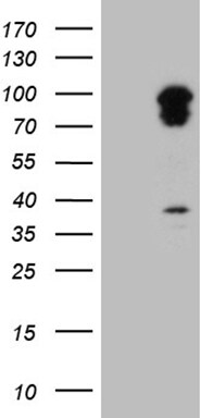 TRAFD1 Antibody (OTI3E8) Western Blot;TRAFD1 Antibody (OTI3E8)[NBP3-44741]-