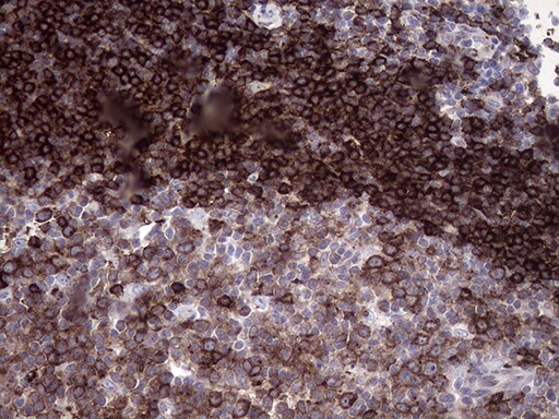 RAB23 Antibody (OTI2A8) Immunohistochemistry;RAB23 Antibody (OTI2A8)[NBP3-44745]-