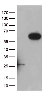 PAMCI Antibody (OTI5E5) Western Blot;PAMCI Antibody (OTI5E5)[NBP3-44747]-