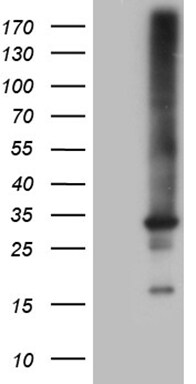 RAB23 Antibody (OTI4C7) Western Blot;RAB23 Antibody (OTI4C7)[NBP3-44748]-