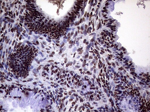 XRN2 Antibody (OTI5F4) Immunohistochemistry;XRN2 Antibody (OTI5F4)[NBP3-44752]-