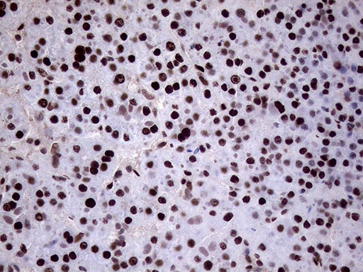 XRN2 Antibody (OTI5F4) Immunohistochemistry;XRN2 Antibody (OTI5F4)[NBP3-44752]-