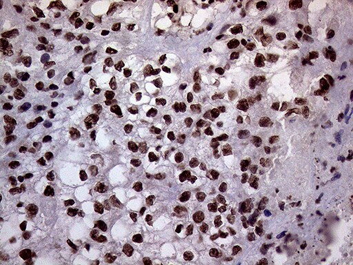 XRN2 Antibody (OTI5F4) Immunohistochemistry;XRN2 Antibody (OTI5F4)[NBP3-44752]-