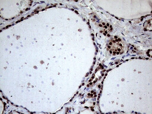 XRN2 Antibody (OTI5F4) Immunohistochemistry;XRN2 Antibody (OTI5F4)[NBP3-44752]-