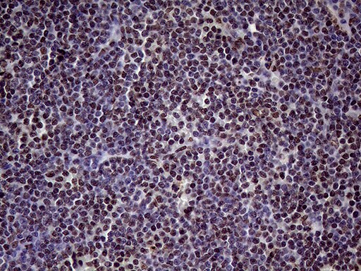 XRN2 Antibody (OTI5F4) Immunohistochemistry;XRN2 Antibody (OTI5F4)[NBP3-44752]-