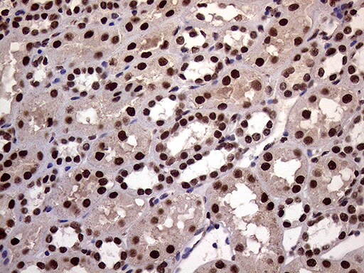 XRN2 Antibody (OTI5F4) Immunohistochemistry;XRN2 Antibody (OTI5F4)[NBP3-44752]-