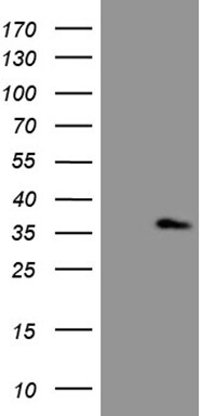 ASB13 Antibody (OTI5G10) Western Blot;ASB13 Antibody (OTI5G10)[NBP3-44753]-