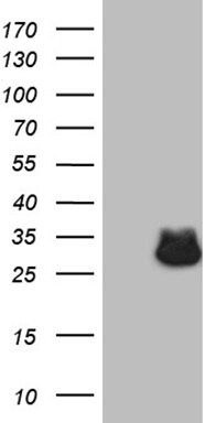 ASB13 Antibody (OTI7E10) Western Blot;ASB13 Antibody (OTI7E10)[NBP3-44755]-