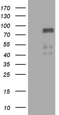 CLIP4 Antibody (OTI5D10) Western Blot;CLIP4 Antibody (OTI5D10)[NBP3-44756]-