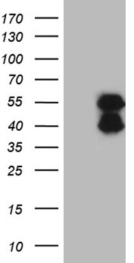 BCL7B Antibody (OTI4B10) Western Blot;BCL7B Antibody (OTI4B10)[NBP3-44763]-
