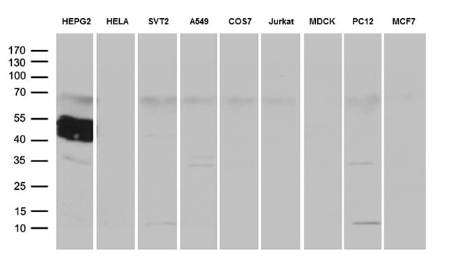 ZCCHC17 Antibody (OTI1F11) Western Blot;ZCCHC17 Antibody (OTI1F11)[NBP3-44765]-