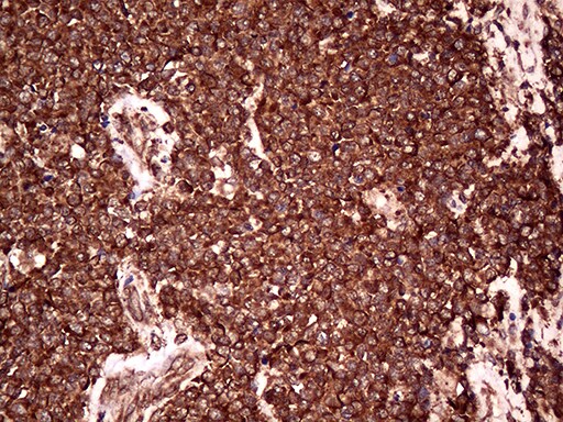 RPL10A Antibody (OTI2G9) Immunohistochemistry;RPL10A Antibody (OTI2G9)[NBP3-44766]-