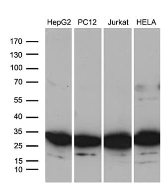 RPL10A Antibody (OTI2G9) Western Blot;RPL10A Antibody (OTI2G9)[NBP3-44766]-