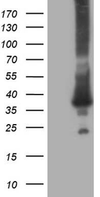 RAB23 Antibody (OTI2F3) Western Blot;RAB23 Antibody (OTI2F3)[NBP3-44767]-