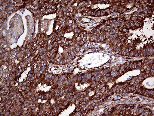 RPL10A Antibody (OTI4B2) Immunohistochemistry;RPL10A Antibody (OTI4B2)[NBP3-44768]-