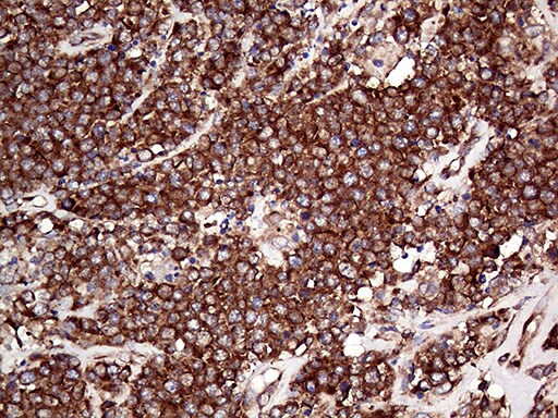 RPL10A Antibody (OTI4B2) Immunohistochemistry;RPL10A Antibody (OTI4B2)[NBP3-44768]-