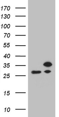 RPL10A Antibody (OTI4B2) Western Blot;RPL10A Antibody (OTI4B2)[NBP3-44768]-