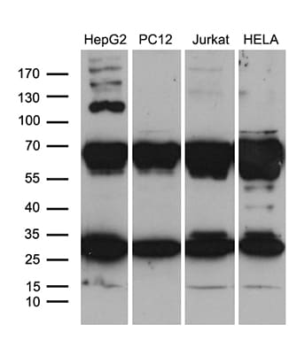 RPL10A Antibody (OTI4B2) Western Blot;RPL10A Antibody (OTI4B2)[NBP3-44768]-