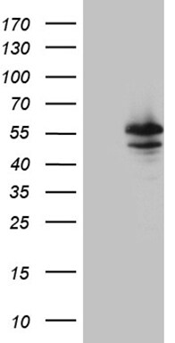 Myotilin Antibody (OTI8A7) Western Blot;Myotilin Antibody (OTI8A7)[NBP3-44772]-