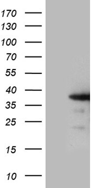 ZCCHC17 Antibody (OTI9A7) Western Blot;ZCCHC17 Antibody (OTI9A7)[NBP3-44773]-