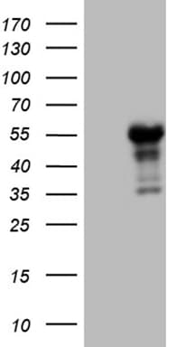 Lhx4 Antibody (OTI4E11) Western Blot;Lhx4 Antibody (OTI4E11)[NBP3-44779]-