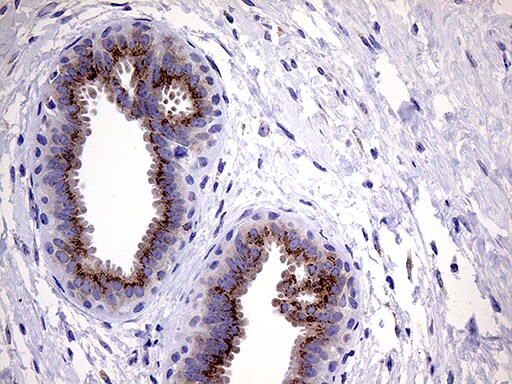 Myotilin Antibody (OTI5E11) Immunohistochemistry;Myotilin Antibody (OTI5E11)[NBP3-44783]-