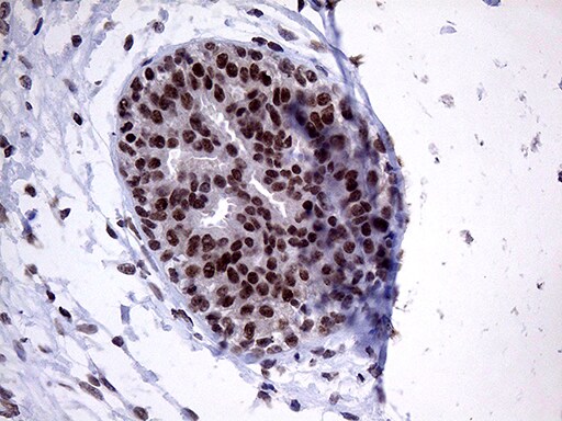 ZNF329 Antibody (OTI2B11) Immunohistochemistry;ZNF329 Antibody (OTI2B11)[NBP3-44788]-